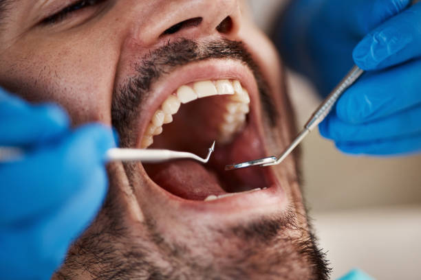 Best Dental Fillings (Composite and Amalgam)  in Mount Morris, IL